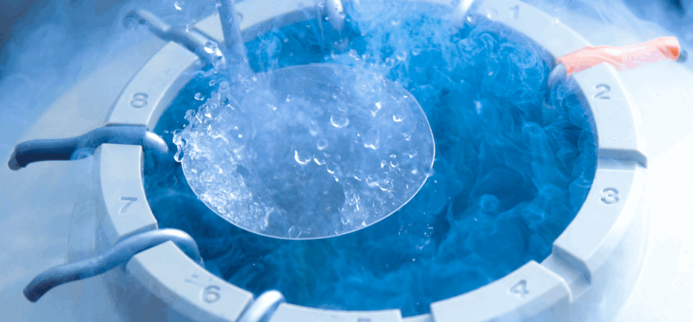 Egg Freezing Explained: Everything You Need to Know